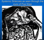 May 7th, 2025: Systemic Sclerosis as Seen Through the Eyes of Paul Klee